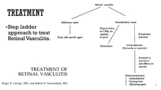 Step ladder
approach to treat
Retinal Vasculitis.
 