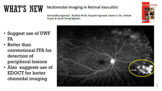• Suggest use of UWF
FA
• Better than
conventional FFA for
detection of
peripheral lesions
• Also suggests use of
EDOCT for better
choroidal imaging
 