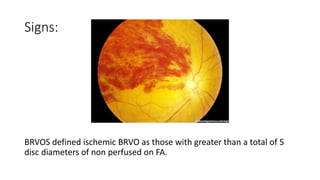 Signs:
BRVOS defined ischemic BRVO as those with greater than a total of 5
disc diameters of non perfused on FA.
 