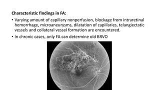 Characteristic findings in FA:
• Varying amount of capillary nonperfusion, blockage from intraretinal
hemorrhage, microaneurysms, dilatation of capillaries, telangiectatic
vessels and collateral vessel formation are encountered.
• In chronic cases, only FA can determine old BRVO
 