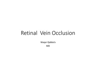 Retinal Vein Occlusion
Waqar Qabba’a
MD
 