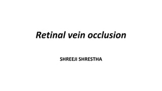 Retinal vein occlusion
SHREEJI SHRESTHA
 
