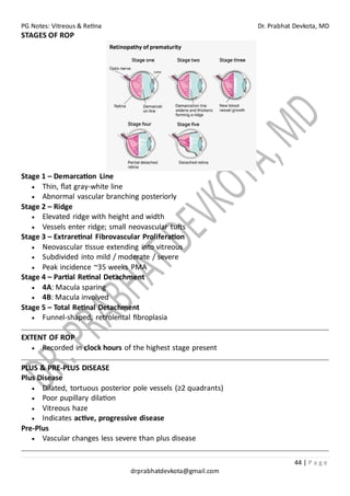 PG Notes: Vitreous & Retina Dr. Prabhat Devkota, MD
44 | P a g e
drprabhatdevkota@gmail.com
STAGES OF ROP
Stage 1 – Demarcation Line
• Thin, flat gray-white line
• Abnormal vascular branching posteriorly
Stage 2 – Ridge
• Elevated ridge with height and width
• Vessels enter ridge; small neovascular tufts
Stage 3 – Extraretinal Fibrovascular Proliferation
• Neovascular tissue extending into vitreous
• Subdivided into mild / moderate / severe
• Peak incidence ~35 weeks PMA
Stage 4 – Partial Retinal Detachment
• 4A: Macula sparing
• 4B: Macula involved
Stage 5 – Total Retinal Detachment
• Funnel-shaped, retrolental fibroplasia
EXTENT OF ROP
• Recorded in clock hours of the highest stage present
PLUS & PRE-PLUS DISEASE
Plus Disease
• Dilated, tortuous posterior pole vessels (≥2 quadrants)
• Poor pupillary dilation
• Vitreous haze
• Indicates active, progressive disease
Pre-Plus
• Vascular changes less severe than plus disease
 