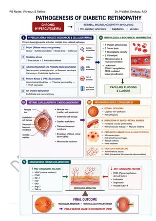 PG Notes: Vitreous & Retina Dr. Prabhat Devkota, MD
58 | P a g e
drprabhatdevkota@gmail.com
 