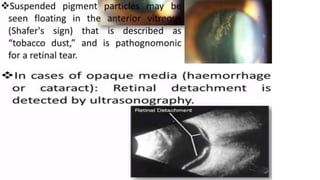 Retina retinal detachment
