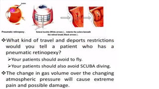 Retina retinal detachment