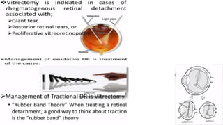 Retina retinal detachment