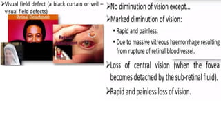 Retina retinal detachment