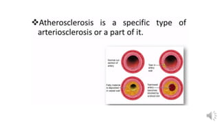 Retina vascular sclerosis