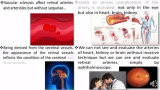 Retina vascular sclerosis