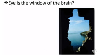 Retina vascular sclerosis