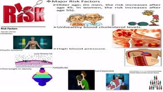 Retina vascular sclerosis