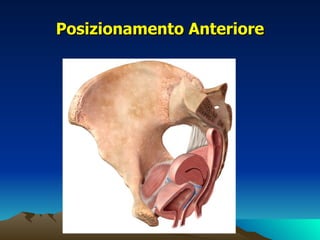 Posizionamento Anteriore
 