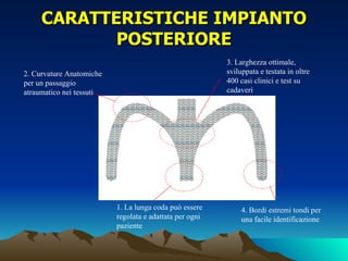 CARATTERISTICHE IMPIANTO
            POSTERIORE
                                                         3. Larghezza ottimale,
2. Curvature Anatomiche                                  sviluppata e testata in oltre
per un passaggio                                         400 casi clinici e test su
atraumatico nei tessuti                                  cadaveri




                          1. La lunga coda può essere         4. Bordi estremi tondi per
                          regolata e adattata per ogni        una facile identificazione
                          paziente
 