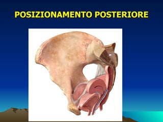 POSIZIONAMENTO POSTERIORE
 