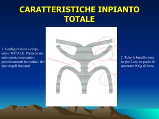 CARATTERISTICHE INPIANTO
                     TOTALE


1. Configurazione a corpo
unico TOTALE. Permette un
unico posizionamento o           2. Tutte le bretelle sono
posizionamenti individuali dei   larghe 2 cm, in grado di
due singoli impianti             sostenere 900g di forza
 