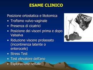 ESAME CLINICO

Posizione ortostatica e litotomica
• Trofismo vulvo-vaginale
• Presenza di cicatrici
• Posizione dei visceri prima e dopo
  Valsalva
• Riduzione viscere prolassato
  (incontinenza latente o
  enterocele)
• Stress Test
• Test elevatore dell’ano
• Esplorazione rettale
 