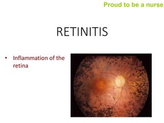 RETINITIS
• Inflammation of the
retina
Proud to be a nurse
 