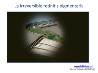 La irreversible retinitis pigmentaria




                                 www.bittelman.cl
                             Doctor Ricardo Bittelman
 