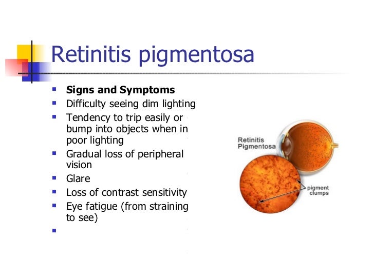 Retinitis pigmentosa 1