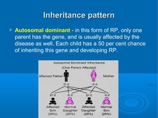 Rp Inheritance Pattern Retinitis pigmentosa | PPT