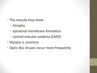 • The macula may show
• Atrophy
• epiretinal membrane formation
• cystoid macular oedema (CMO)
• Myopia is common.
• Optic disc drusen occur more frequently
 