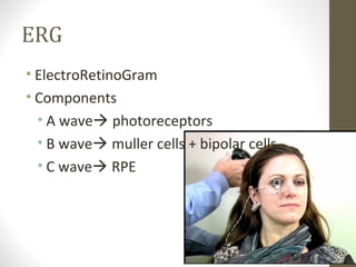 ERG
• ElectroRetinoGram
• Components
• A wave photoreceptors
• B wave muller cells + bipolar cells
• C wave RPE
 