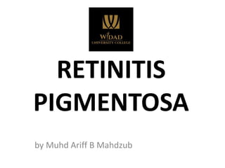RETINITIS
PIGMENTOSA
by Muhd Ariff B Mahdzub
 