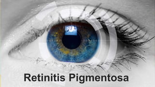 Retinitis Pigmentosa
 