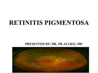 RETINITIS PIGMENTOSA
PRESENTED BY: DR. MLALUKO, MD
 