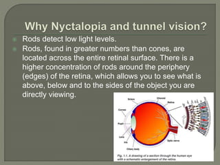 The Rods Detect Retinitis Pigmentosa.pptx