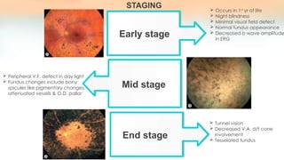 Decreases Visual Sign Approach to a case of Retinitis Pigmentosa.pptx