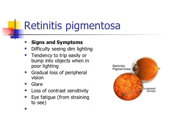 Retinitis pigmentosa 3