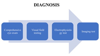 DIAGNOSIS
Comprehensive
eye exam
Visual field
testing
Electrophysiolo
gy test
Imaging test
 