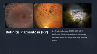 Retinitis Pigmentosa (RP) Dr. Pradeep Bastola, MBBS, MD, MPH,
Professor, Department of Ophthalmology,
Chitwan Medical College Teaching Hospital,
Nepal
 