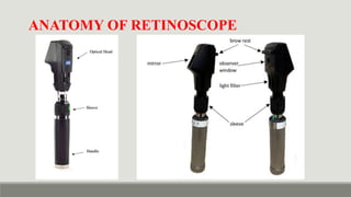 Dynamic Ret Retinoscopy & It's Principle - static vs dynamic retinoscopy in detail ...
