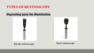 Dynamic Ret Retinoscopy & It's Principle - static vs dynamic retinoscopy in detail ...