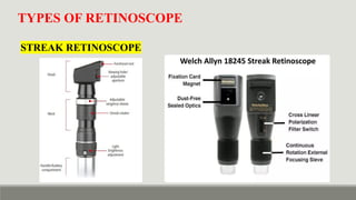Dynamic Ret Retinoscopy & It's Principle - static vs dynamic retinoscopy in detail ...