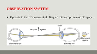 Dynamic Ret Retinoscopy & It's Principle - static vs dynamic retinoscopy in detail ...