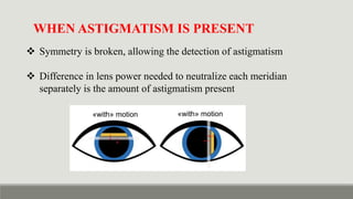 Retinoscopy & It's Principle - static vs dynamic retinoscopy in detail ...