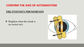 Retinoscopy & It's Principle - static vs dynamic retinoscopy in detail ...