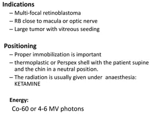 Retinoblastoma | PPTX