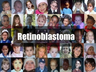 Retinoblastoma 