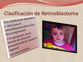 Examen del fondo ocular bilateral con 360 grados de depresión escleral es obligatoria. La visualización directa del tumor mediante un oftalmoscopio indirecto de diagnóstico de retinoblastoma en más del 90% de los casos. 21 RetCam es un fondo de gran ángulo de la cámara, útil para documentar con precisión Ing. retinoblastoma y response seguimiento al tratamiento . 