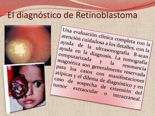 TC delimita la extensión extraocular y puede detectar un pinealoblastoma asociados  