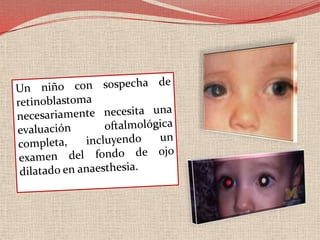 La resonancia magnética es especialmente indicada cuando se sospecha la invasión del nervio óptico o la extensión intracraneal. La angiografía con fluoresceína, muestra pequeños retinoblastomas y dilatada alimentación en la fase arterial, hiper-manchas en la fase venosa y tardía de tinción . 