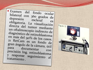 Consejo genético y diagnóstico prenatalDesde la observación que el retinoblastoma era una enfermedad con un componente hereditario, se intentó ofrecer un consejo genético basado en porcentajes calculados a partir de datos genéticos, como el tipo de herencia y la penetrancia y de datos clínicos, como que el tumor sea unilateral o bilateral.