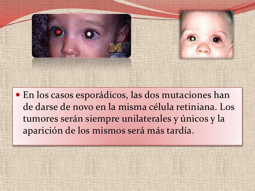 Mutaciones en el RB1<br />Se han descrito diferentes mutaciones en el gen, grandes deleciones, translocaciones, pequeñas d...