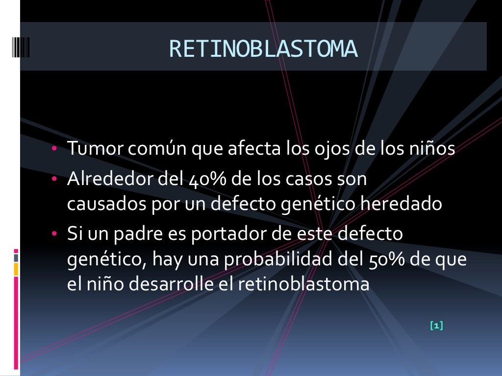 Retinoblastoma