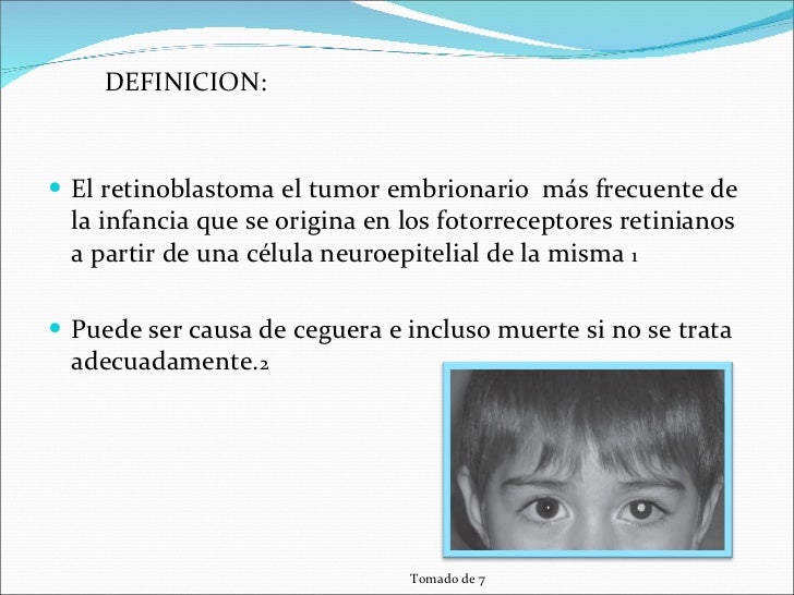 Retinoblastoma